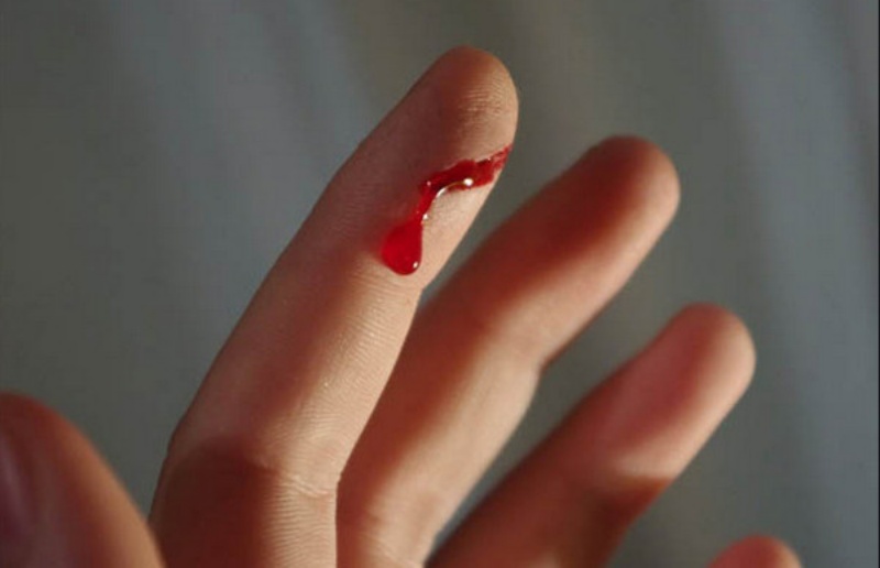 Mơ thấy gọt hoa quả bị dao cứa đứt tay chảy máu